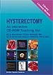 Hysterectomy - Interactive Teaching Aid